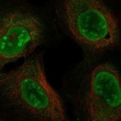 DDX5 Rabbit anti-Human, Polyclonal, Novus Biologicals 100 &mu;g | Buy Online | Novus Biologicals | Fisher Scientific