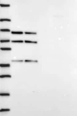 DDX5 Rabbit anti-Human, Polyclonal, Novus Biologicals 100 &mu;g | Buy Online | Novus Biologicals | Fisher Scientific
