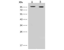 DDX50 Antibody, Novus Biologicals 100 &mu;g, Unconjugated:Antibodies, Polyclonal
