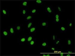 DDX54 Antibody (2H6), Novus Biologicals 0.1 mg | Buy Online | Novus Biologicals | Fisher Scientific