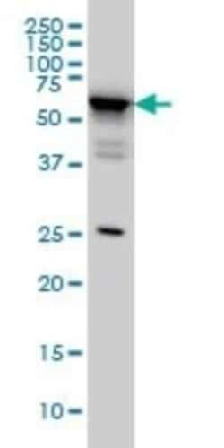 DDX56 Antibody (4C5), Novus Biologicals 0.1 mg, Unconjugated:Antibodies,