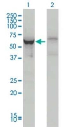 DDX56 Antibody (4C5), Novus Biologicals 0.1 mg, Unconjugated:Antibodies,
