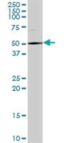 DDX59 Antibody, Novus Biologicals 0.05 mg | Buy Online | Novus Biologicals | Fisher Scientific