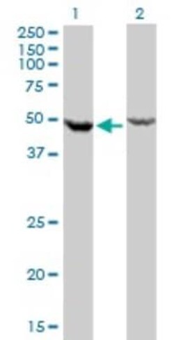 Novus Biologicals DDX6 Antibody (3D2), Novus Biologicals 0.1 mg | Buy Online | Novus Biologicals&trade; | Fisher Scientific