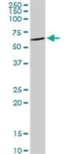 DDX6 Antibody, Novus Biologicals 0.1 mg | Buy Online | Novus Biologicals | Fisher Scientific