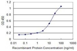 DECR1 Antibody (3D4), Novus Biologicals 0.1 mg; Unconjugated:Antibodies,