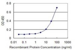 DECR2 Antibody (4A7), Novus Biologicals 0.1 mg; Unconjugated:Antibodies,