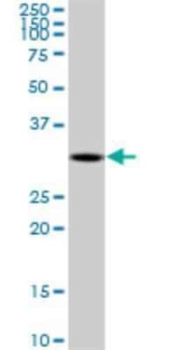 DECR2 Antibody (4A7), Novus Biologicals 0.1 mg; Unconjugated:Antibodies,