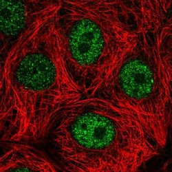 DEDD Antibody, Novus Biologicals 100 &mu;L | Buy Online | Novus Biologicals | Fisher Scientific