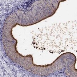 DEFB129 Antibody, Novus Biologicals:Antibodies:Primary Antibodies