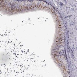 DEFB136 Antibody, Novus Biologicals 25ul; Unconjugated:Antibodies, Polyclonal