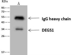 DEGS1 Antibody, Novus Biologicals 50 &mu;g; Unconjugated:Antibodies, Polyclonal