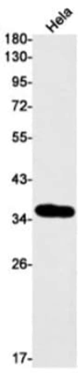 DEGS1 Antibody (S03-5D2), Novus Biologicals™