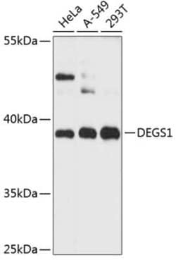 DEGS1 Antibody - Azide and BSA Free, Novus Biologicals™