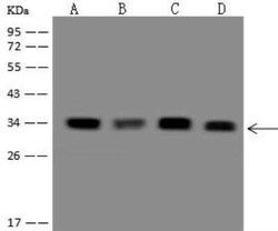 DEGS1 Antibody, Novus Biologicals 50 &mu;g; Unconjugated:Antibodies, Polyclonal