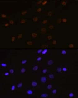 DEK Rabbit anti-Human, Rat, Clone: 2C2V8, Novus Biologicals 100 &mu;g;