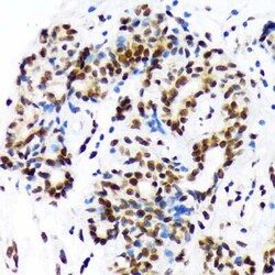 DEK Rabbit anti-Human, Rat, Clone: 2C2V8, Novus Biologicals 100 &mu;g;