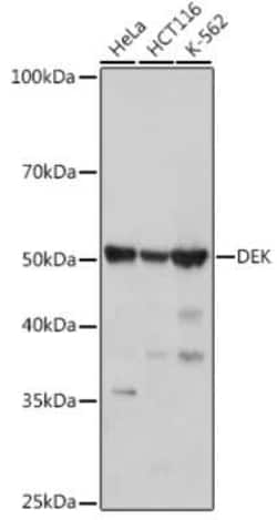 DEK Rabbit anti-Human, Rat, Clone: 2C2V8, Novus Biologicals 100 &mu;g;