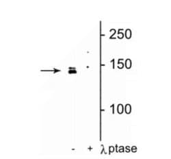 DENND3, p Ser554 Antibody, Novus Biologicals 100 &mu;L | Buy Online | Novus Biologicals | Fisher Scientific