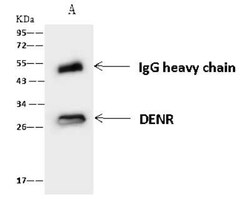 DENR Antibody, Novus Biologicals 50 &mu;g, Unconjugated:Antibodies, Polyclonal