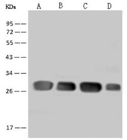 DENR Antibody, Novus Biologicals 50 &mu;g, Unconjugated:Antibodies, Polyclonal