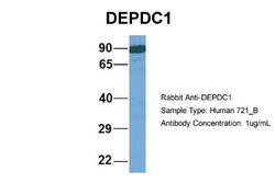 DEPDC1A Rabbit anti-Human, Polyclonal, Novus Biologicals 0.1 mL | Buy Online | Novus Biologicals | Fisher Scientific