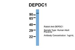 DEPDC1A Rabbit anti-Human, Polyclonal, Novus Biologicals 0.1 mL | Buy Online | Novus Biologicals | Fisher Scientific