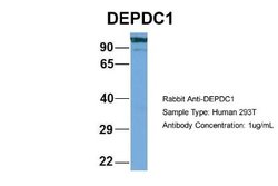 DEPDC1A Rabbit anti-Human, Polyclonal, Novus Biologicals 0.1 mL | Buy Online | Novus Biologicals | Fisher Scientific