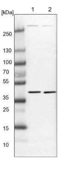 DEPTOR/DEPDC6 Antibody, Novus Biologicals 25 &mu;L | Buy Online | Novus Biologicals | Fisher Scientific