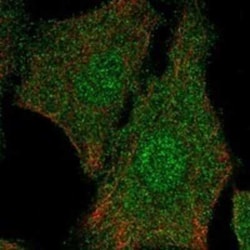 DERP6 Rabbit anti-Human, Polyclonal, Novus Biologicals 25 &mu;g; Unconjugated:Antibodies,
