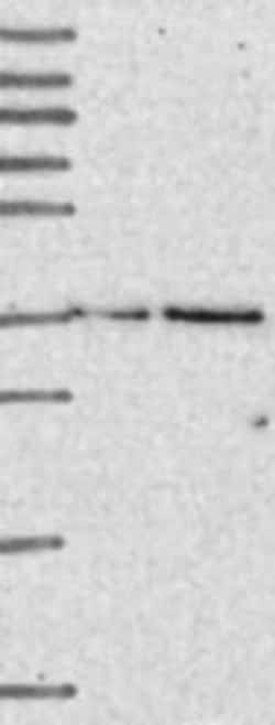 DERP6 Rabbit anti-Human, Polyclonal, Novus Biologicals 25 &mu;g; Unconjugated:Antibodies,