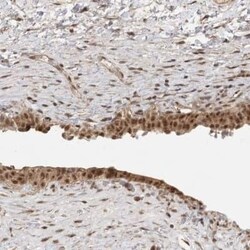 DFF45/ICAD Antibody, Novus Biologicals:Antibodies:Primary Antibodies