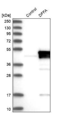 DFF45/ICAD Antibody, Novus Biologicals:Antibodies:Primary Antibodies