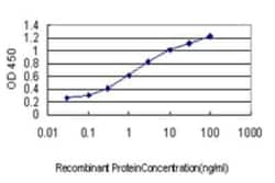 DFNB31 Antibody (1D9), Novus Biologicals 0.1 mg | Buy Online | Novus Biologicals | Fisher Scientific