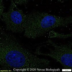 DGAT2 Antibody - BSA Free, Novus Biologicals:Antibodies:Primary Antibodies