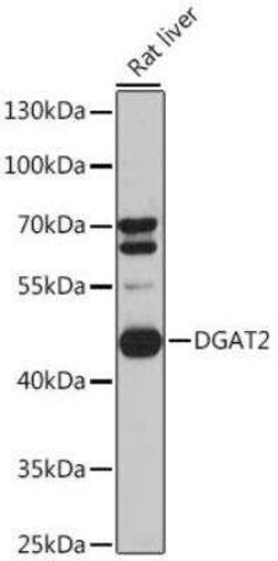 DGAT2 Antibody - Azide and BSA Free, Novus Biologicals:Antibodies:Primary