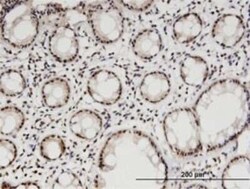 DGCR8 Antibody (4G3), Novus Biologicals 0.1 mg | Buy Online | Novus Biologicals | Fisher Scientific