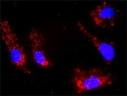 DGK-alpha Antibody (2B7), Novus Biologicals 0.1 mg | Buy Online | Novus Biologicals | Fisher Scientific