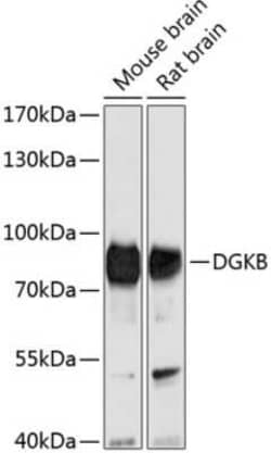 DGK-beta Antibody - Azide and BSA Free, Novus Biologicals:Antibodies:Primary