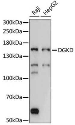 DGK-delta Antibody - Azide and BSA Free, Novus Biologicals:Antibodies:Primary