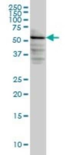 DGK-epsilon Antibody (7E1), Novus Biologicals 0.1 mg | Buy Online | Novus Biologicals | Fisher Scientific