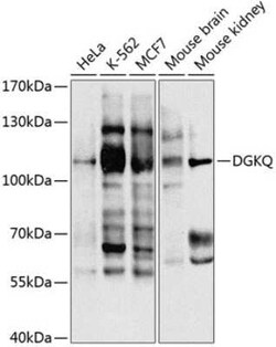 DGK-theta Antibody - BSA Free, Novus Biologicals 0.02 mL, Unconjugated:Antibodies,