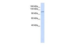 DGKH Antibody, Novus Biologicals 100 &mu;L; Unconjugated:Antibodies, Polyclonal