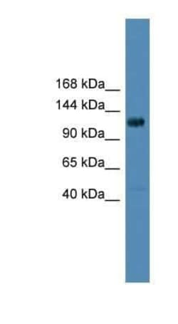 DGK-theta Antibody, Novus Biologicals 100 &mu;g; Unconjugated:Antibodies,