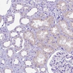 DHRS2 Antibody, Novus Biologicals 25 &mu;L, Unconjugated:Antibodies, Polyclonal