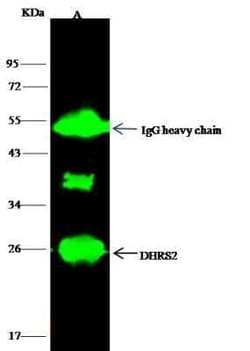DHRS2 Antibody, Novus Biologicals 100 &mu;g | Buy Online | Novus Biologicals | Fisher Scientific