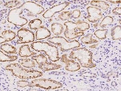 DHRS4 Antibody, Novus Biologicals 100 &mu;g | Buy Online | Novus Biologicals | Fisher Scientific