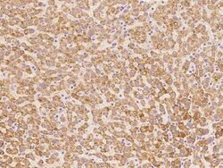 DHRS4 Antibody, Novus Biologicals 100 &mu;g | Buy Online | Novus Biologicals | Fisher Scientific