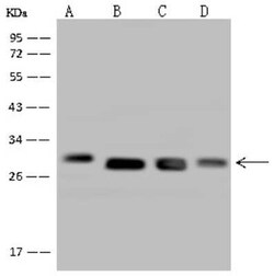 DHRS4 Antibody, Novus Biologicals 100 &mu;g | Buy Online | Novus Biologicals | Fisher Scientific