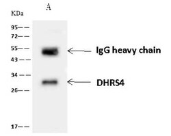 DHRS4 Antibody, Novus Biologicals 100 &mu;g | Buy Online | Novus Biologicals | Fisher Scientific